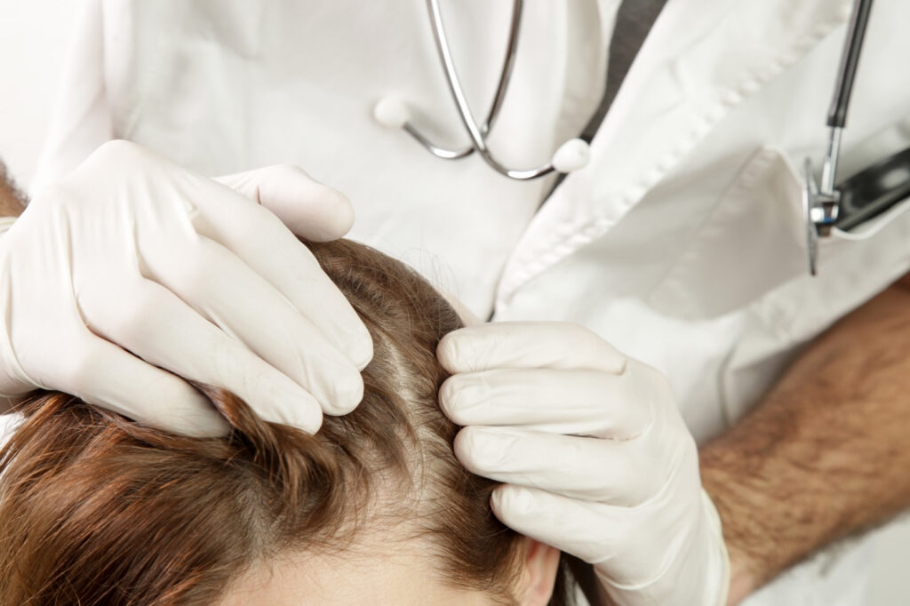 Woman with problematic hair