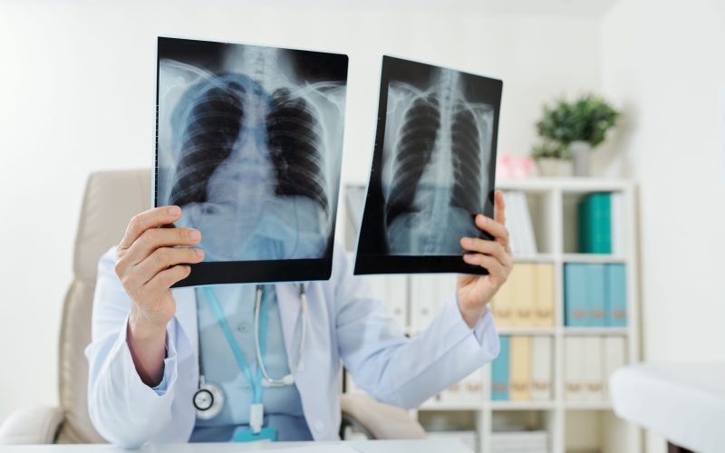 Doctor comparing two lungs x-rays of patient after his recovery