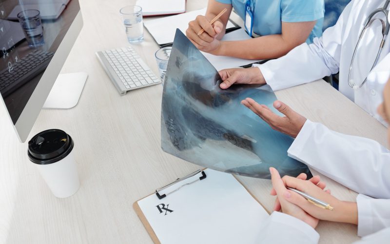 Physicians examining lungs x-ray